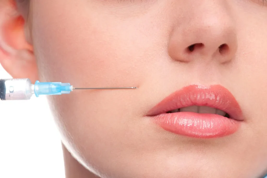 Are Dermal Fillers Permanent? Understanding Filler Types
