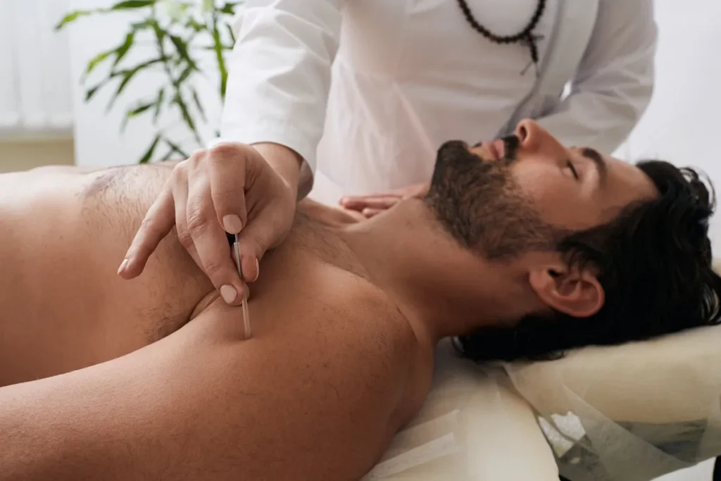 Aching After Acupuncture: Is It Normal Healing?