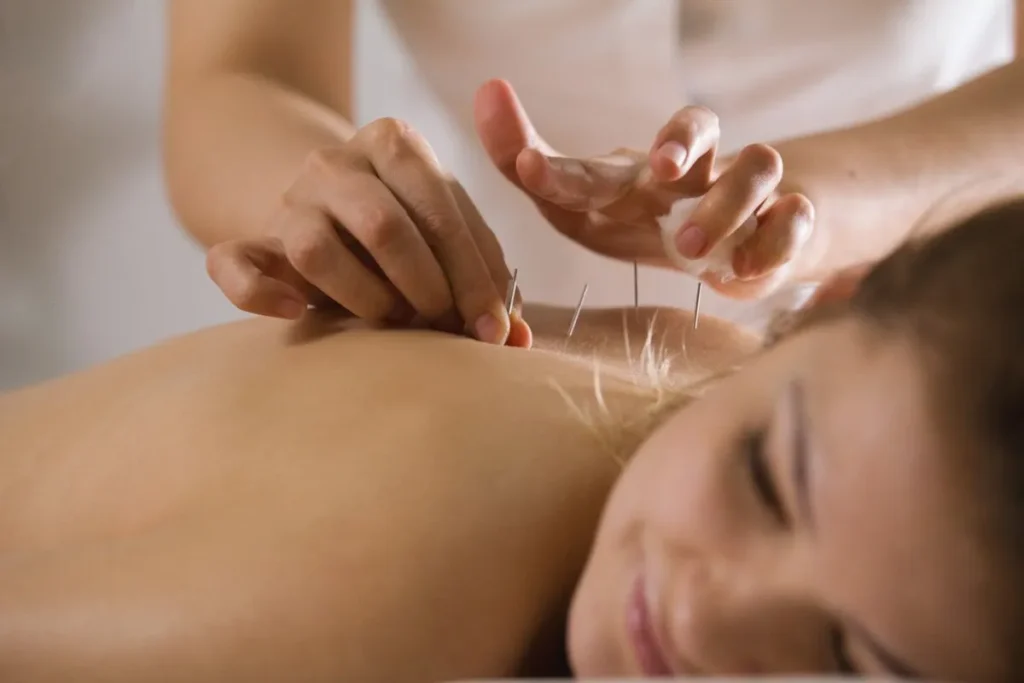 Acupuncture Aftercare: Brilliant Tips For Healing