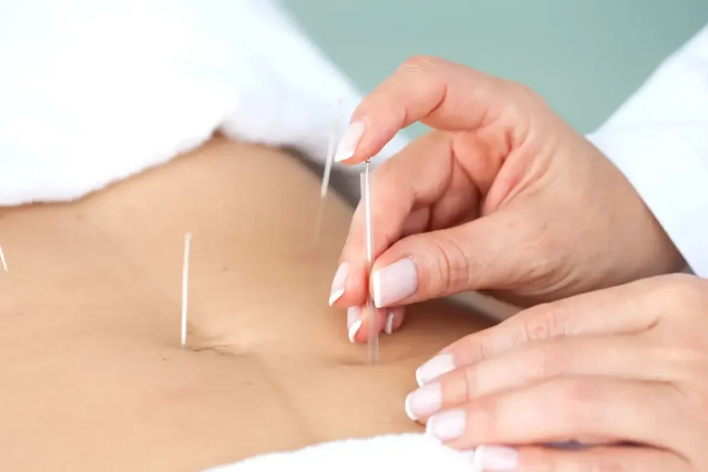 Acupuncture And Conception: Great Natural Way