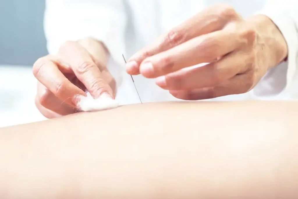 Acupunctuur Diagram Punten: Verbazingwekkende Lichaamskaart