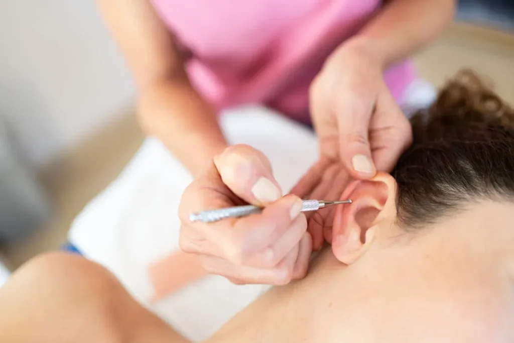 Acupuncture Ear: Instant Relief For Pain