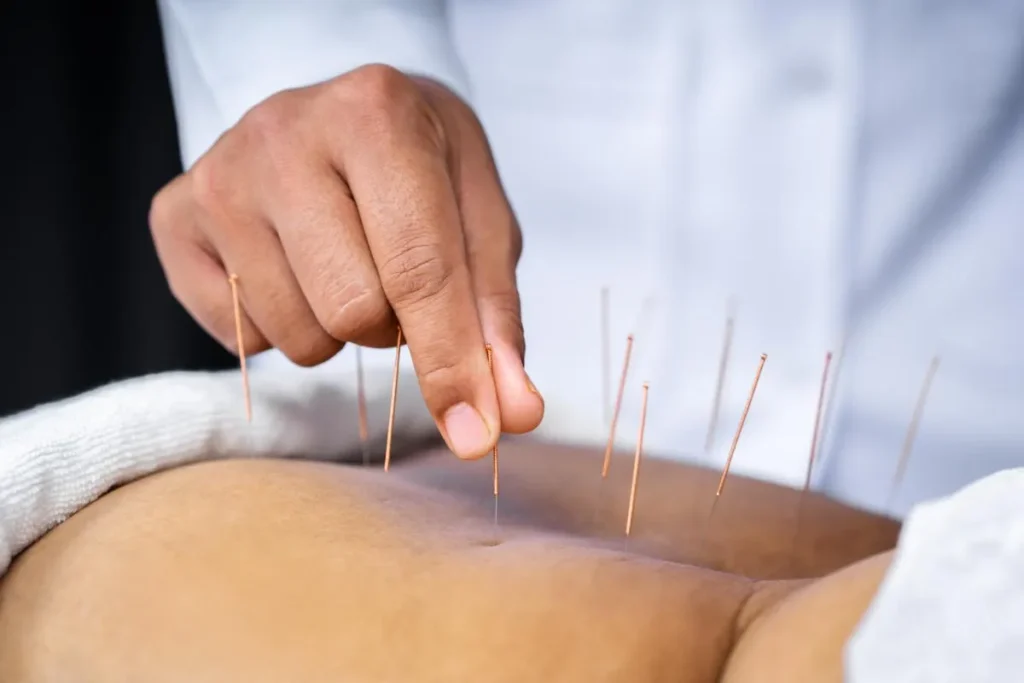 Acupuncture Etiquette: Perfect Rules For All