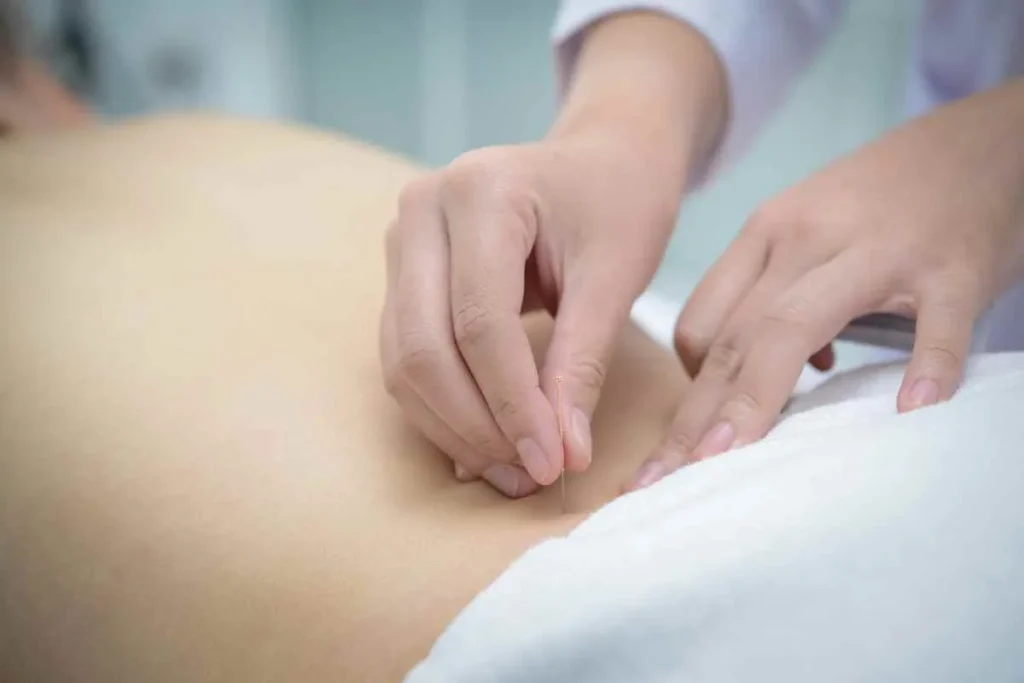 Acupuncture Etiquette: Perfect Rules For All