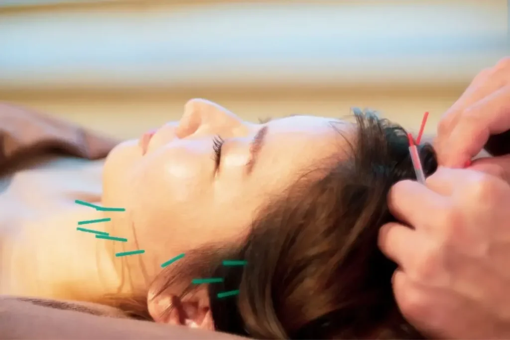 Acupuncture Points On Head Chart: Top Guide