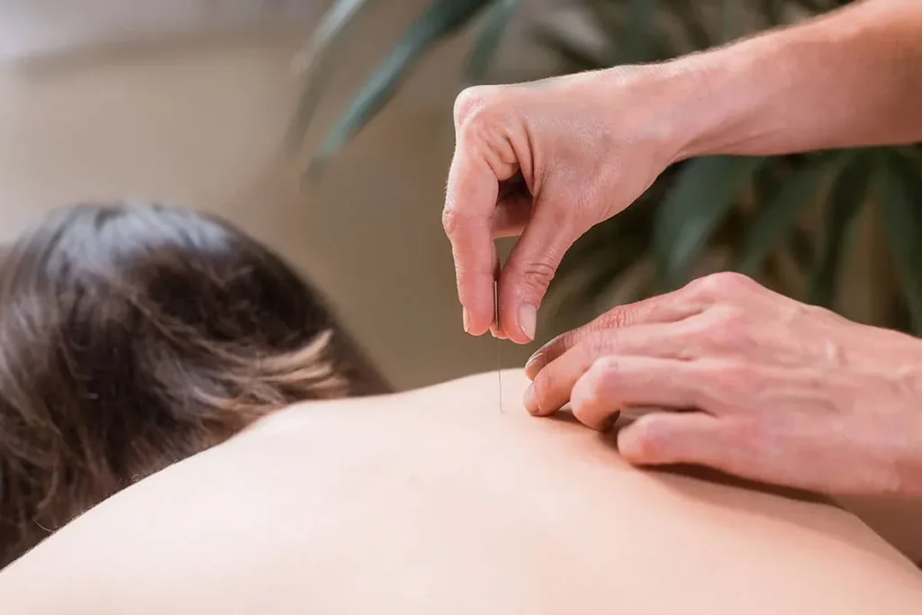 Acupuncture Points On Head Chart: Top Guide