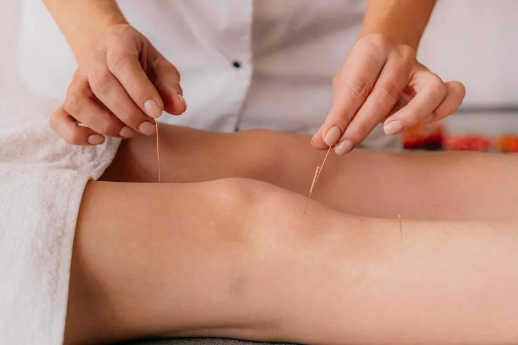 Acupuncture Side Effects Nerve Damage: Truth