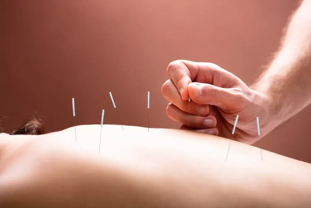 Acupuncture Side Effects Nerve Damage: Truth