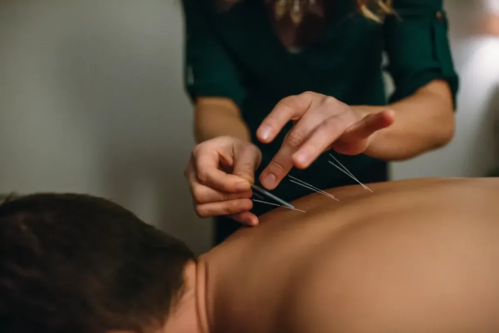 Acupuncture Therapy For Fertility: Great Results