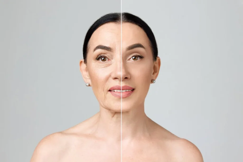 Aging Face: Effective Ways To Restore Youth