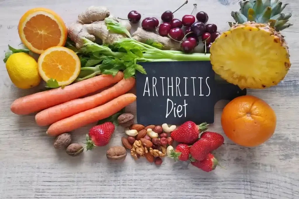 Anti Arthritis Diet: Amazing Healing Foods
