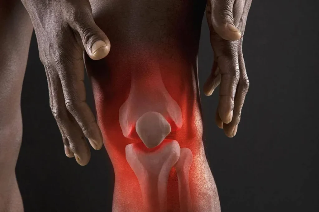 Anti Arthritis Diet: Amazing Healing Foods