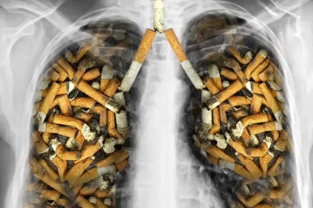 Best Detox For Smokers: Powerful Cleanse