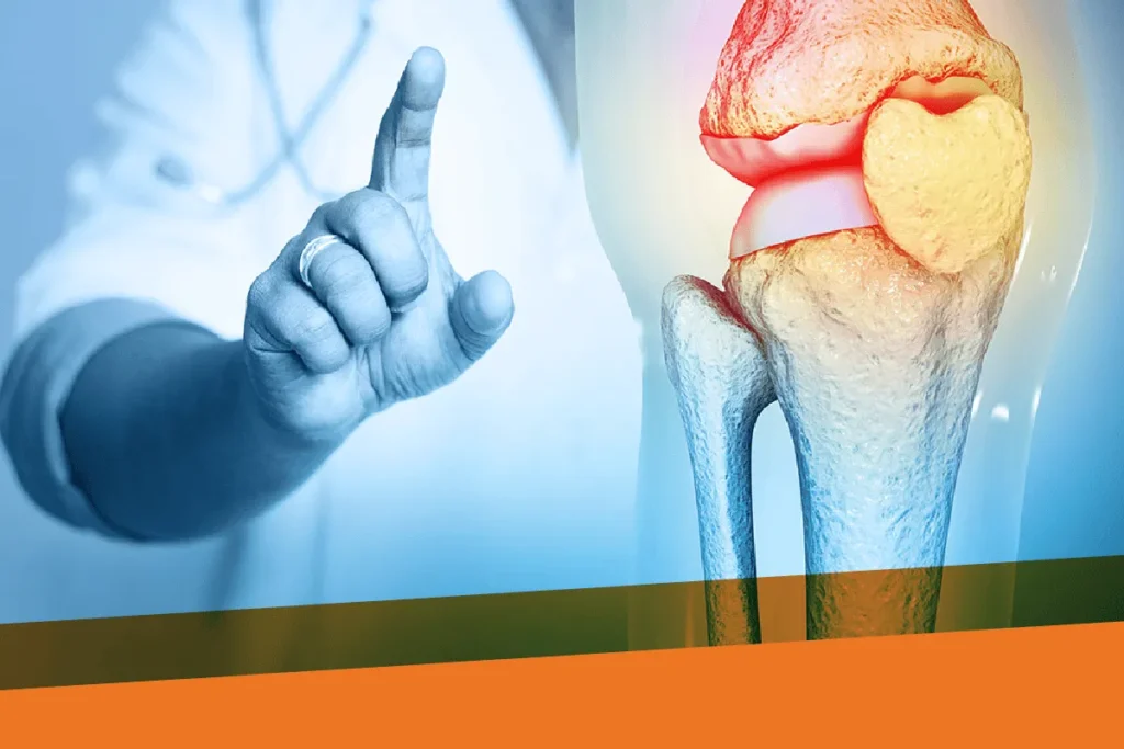 Best Food For Joints: Powerful Relief Plan