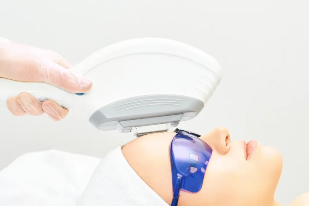 Best Laser For Age Spots: Brilliant Results