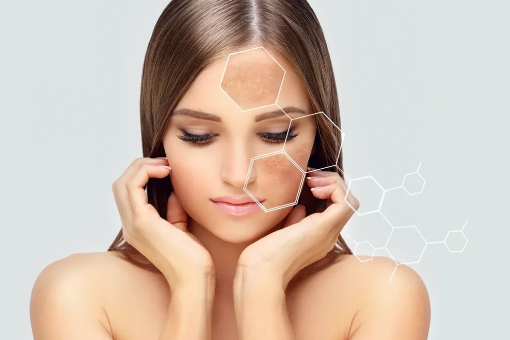 How Laser for Sun Spots Works