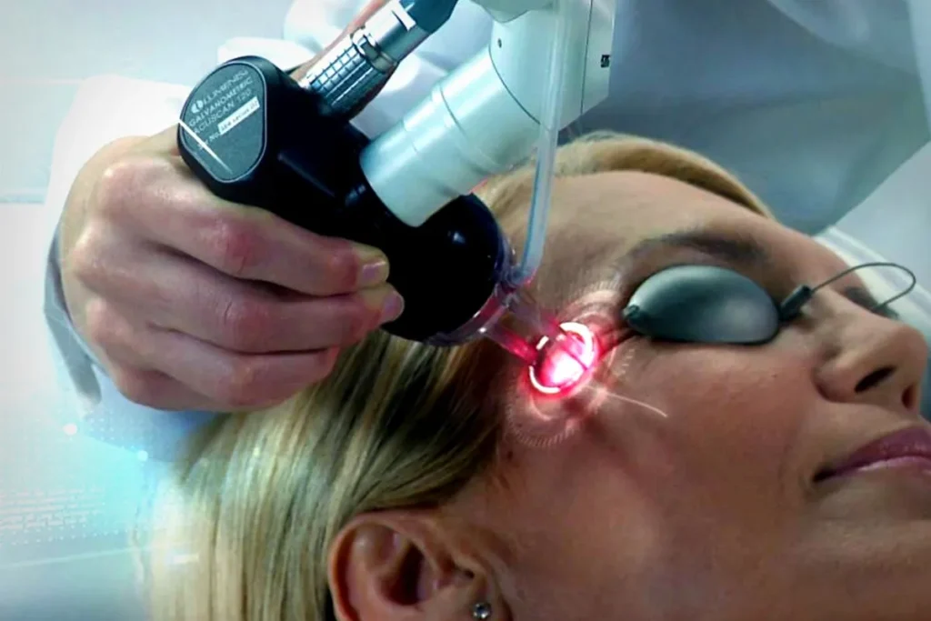 The Best Laser for Under Eyes: Types and Technologies