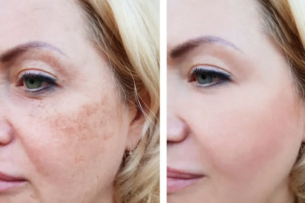 The Science Behind Natural Pain Relief