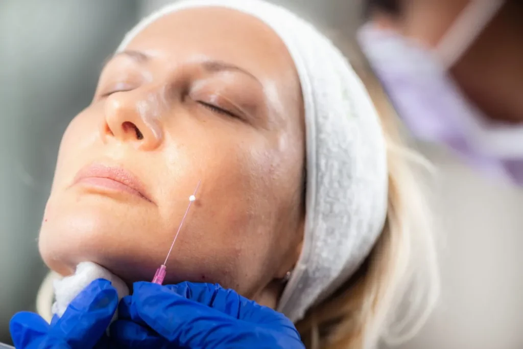 Top 5 Best Non-Invasive Face Lift Treatments in 2025