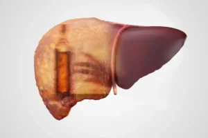 A healthy liver compared to a damaged liver