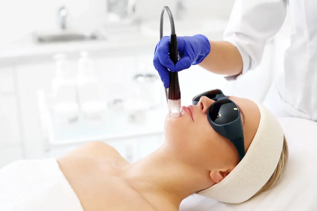 The CO2 Laser Treatment Procedure