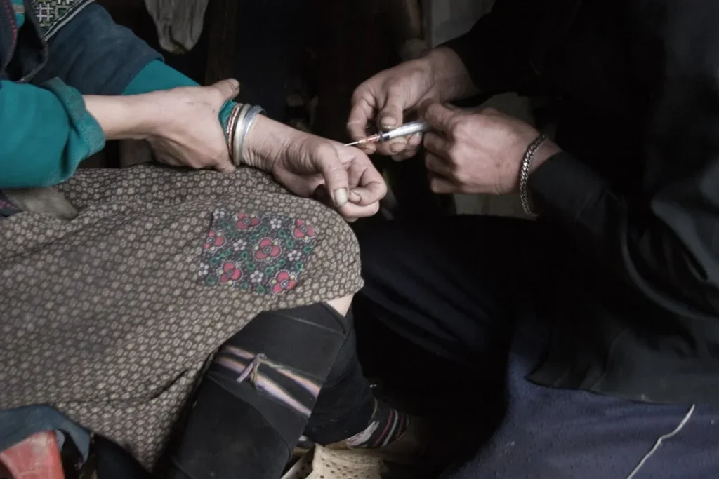 Heroin Addict Signs: Critical Warning Indicators