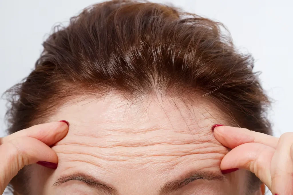 How To Get Rid Of Wrinkles: Best Natural Ways
