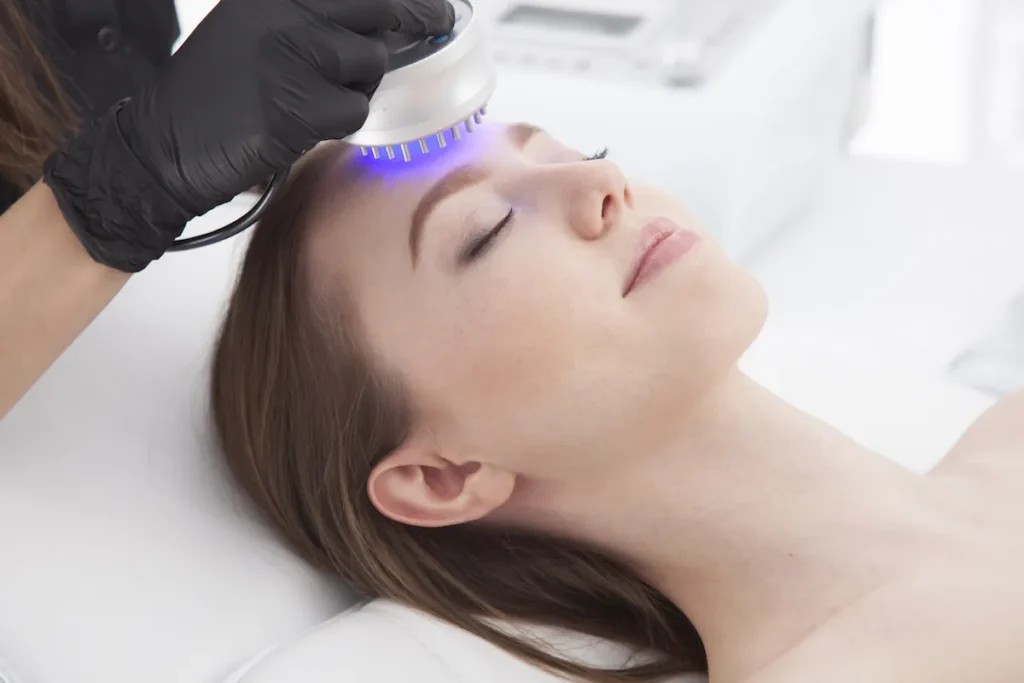 Laser Procedure For Acne: Amazing Clear Skin