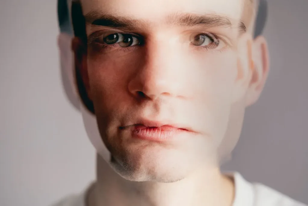 Manic Depressive Disorder With Psychotic Features