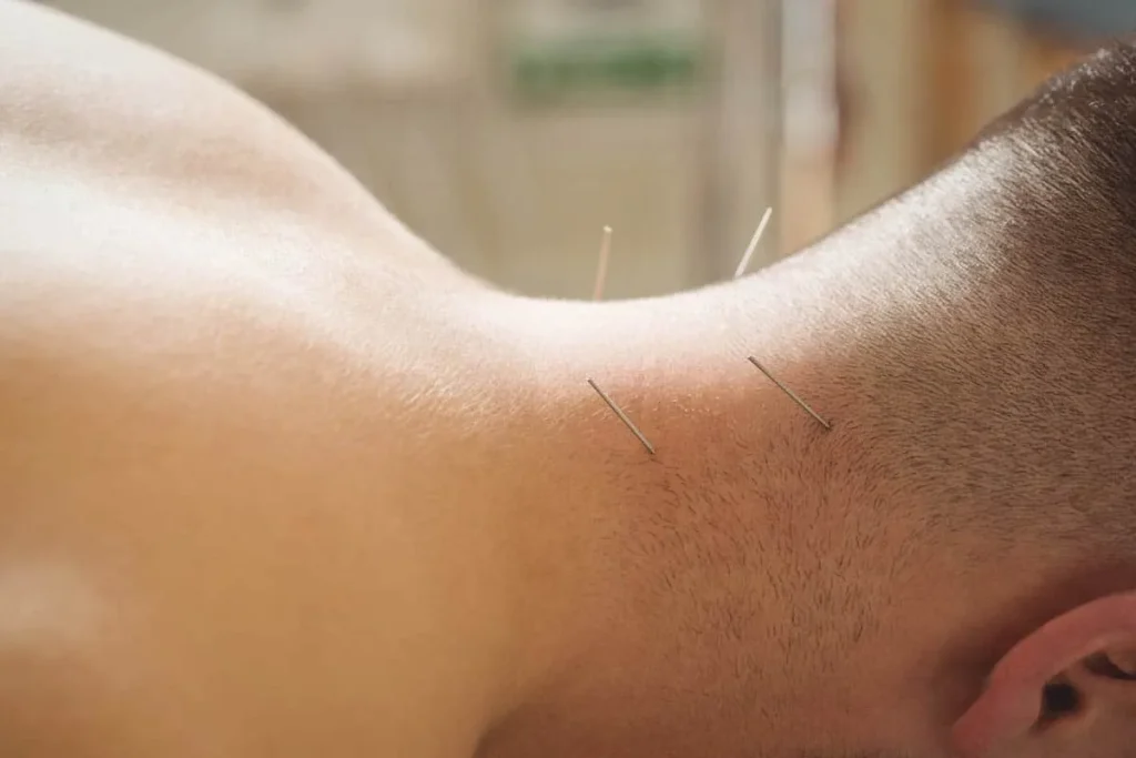 Neck Acupuncture Points Chart: Amazing Healing