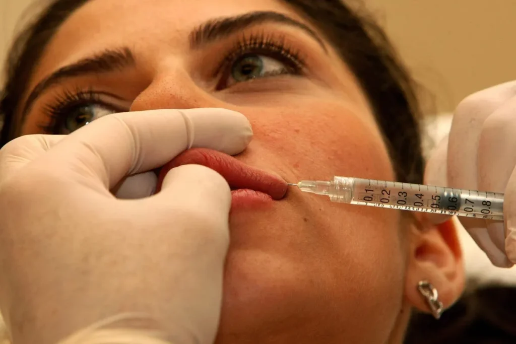 Infected Lip Filler: Best Fast Relief Tips
