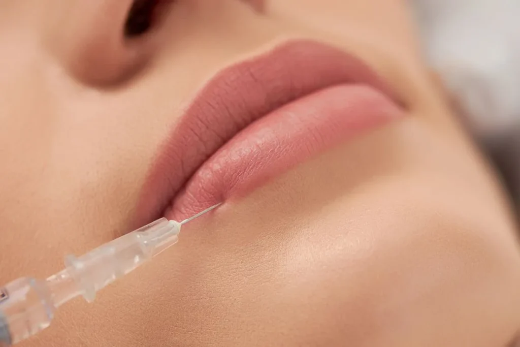Identifying an Infected Lip Filler