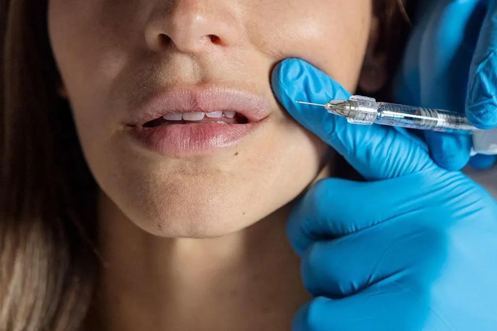 Understanding Normal vs. Abnormal Lip Filler Reactions