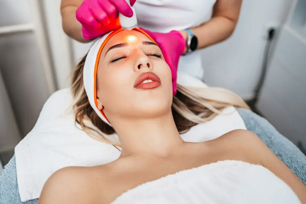 Gezichtsbehandeling met laser: Gids met de beste keuzes