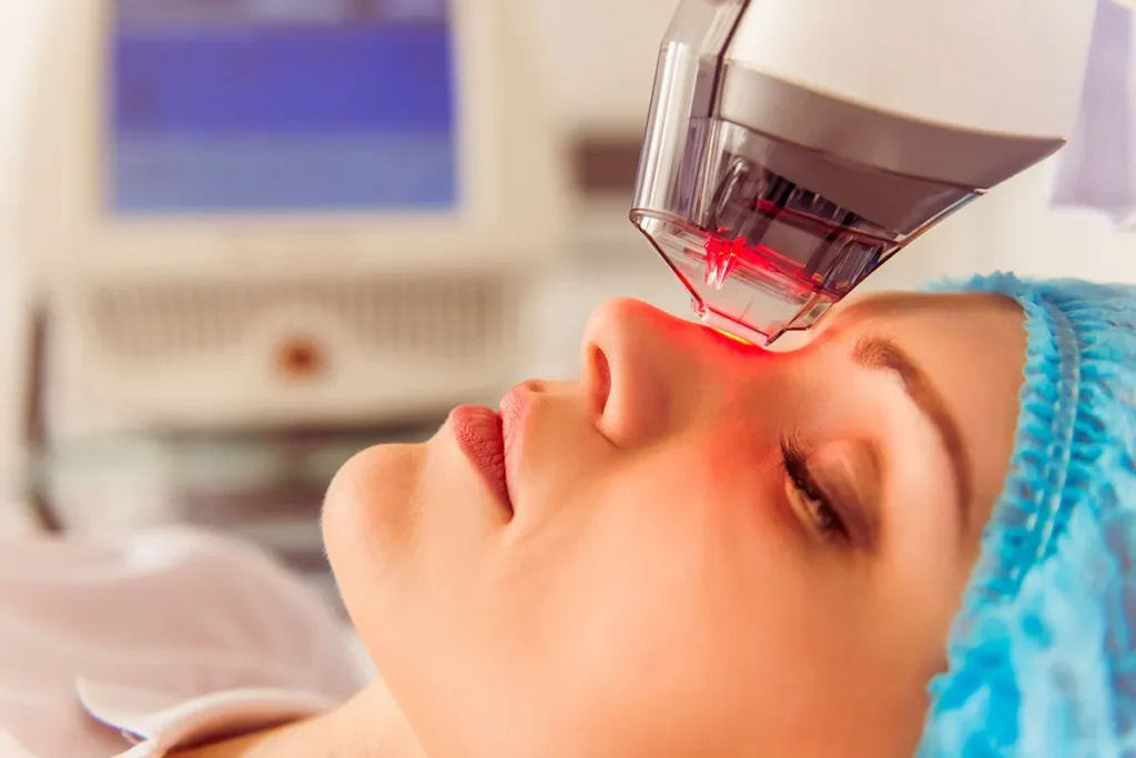 7 Best Laser Treatments for Face: Complete Guide