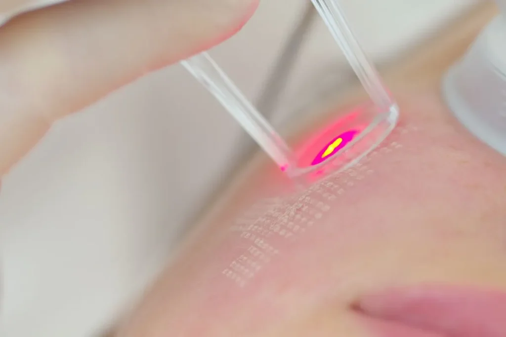 7 Best Laser Treatments for Face: Complete Guide