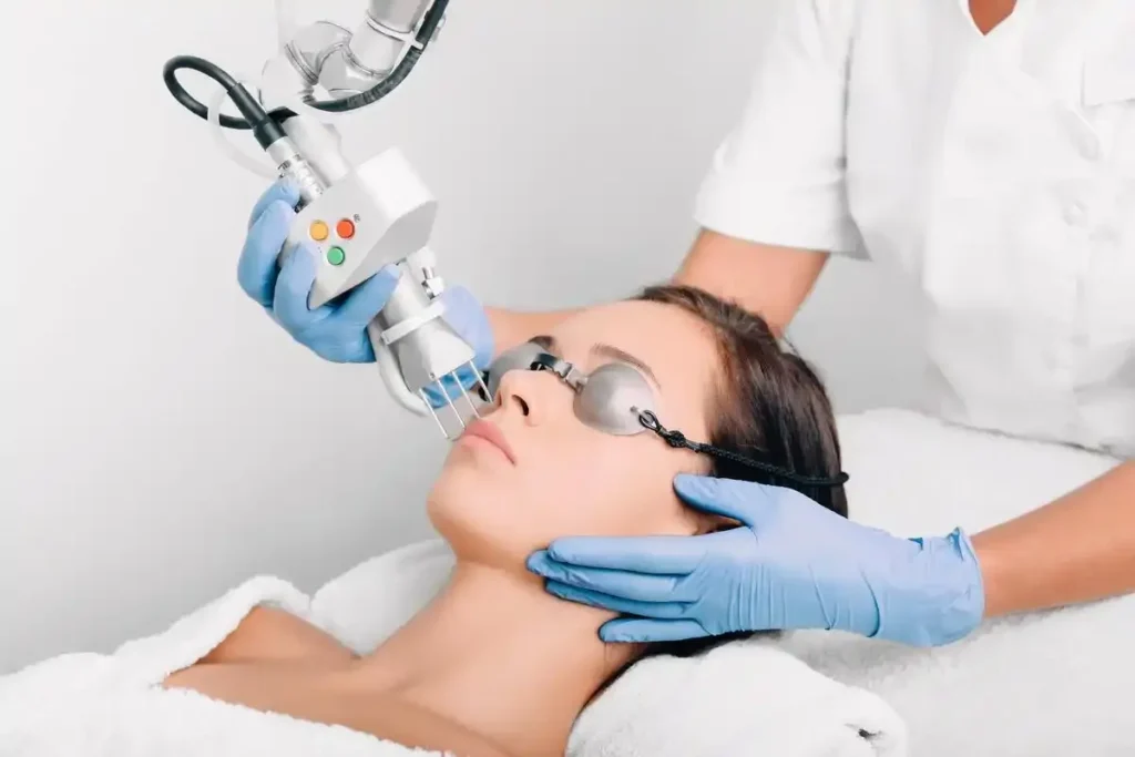 Fractional Skin Resurfacing: Amazing Results