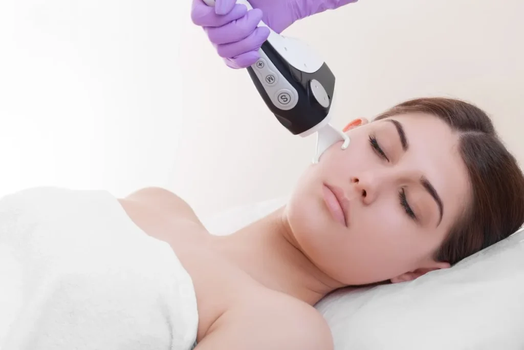 Co2 Fractional Resurfacing Laser Treatment: Best