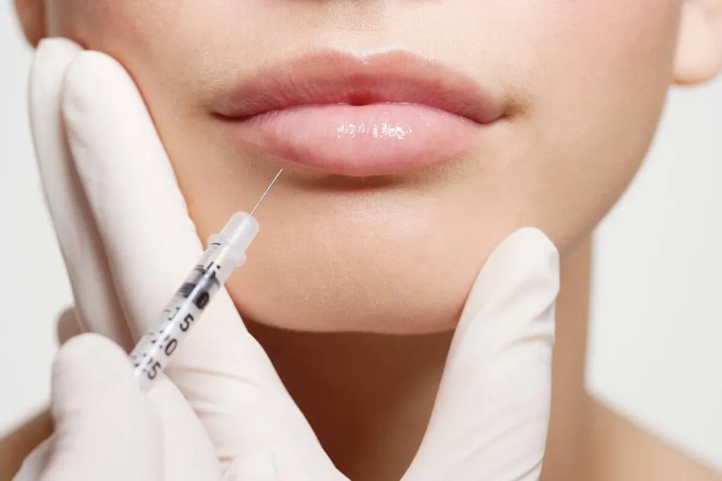 Big Botox Lips: Best Guide To Amazing Looks