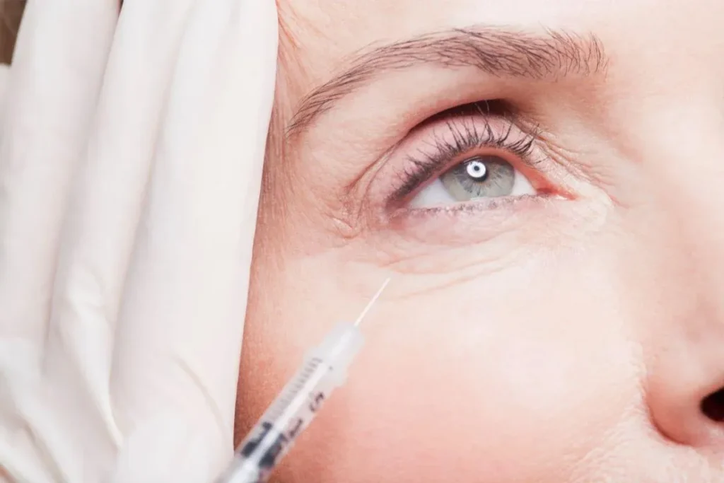 Does Botox Work for Under Eye Bags? The Science Explained