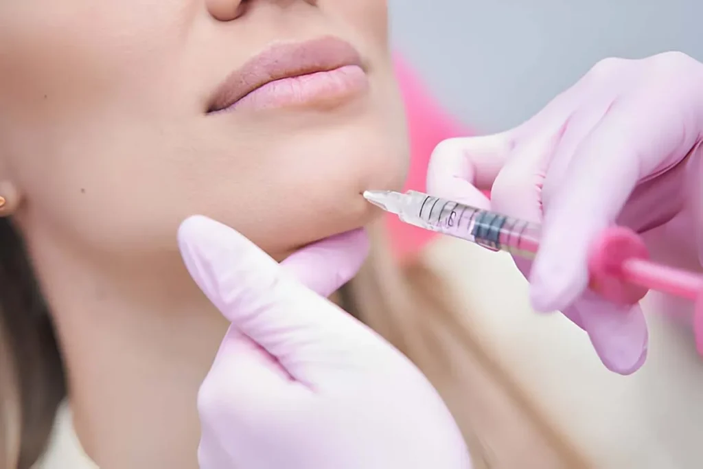 How Long Does Fillers Last? Best Amazing Guide