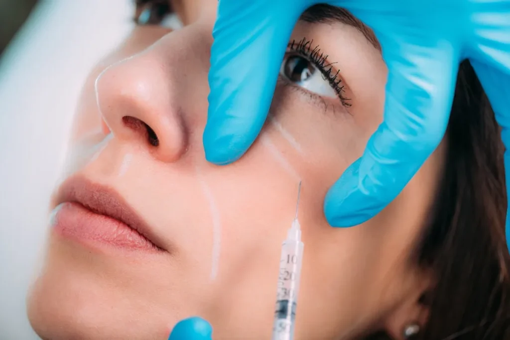 Cheek Augmentation Dermal Fillers: Best Tips