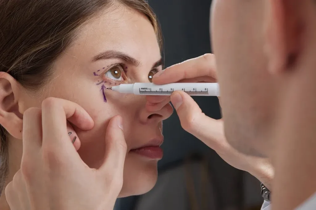 Cheek And Under Eye Fillers: Amazing Wow Fix
