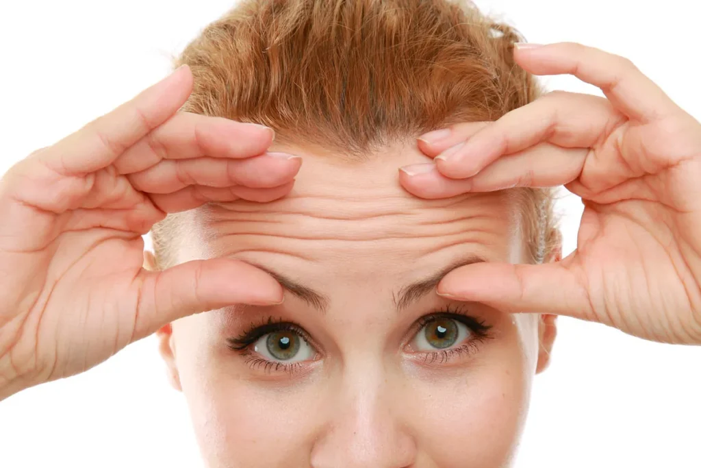 Cure Forehead Wrinkles: Best Amazing Methods