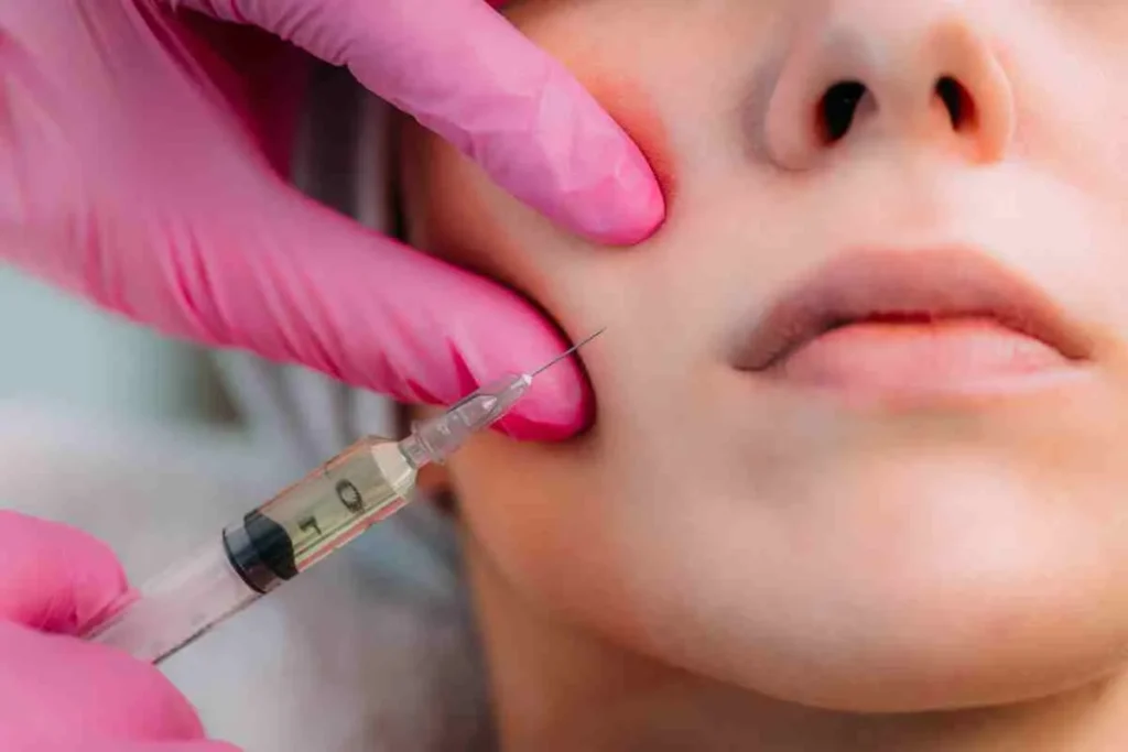 Filler Removal Before And After: Best Results