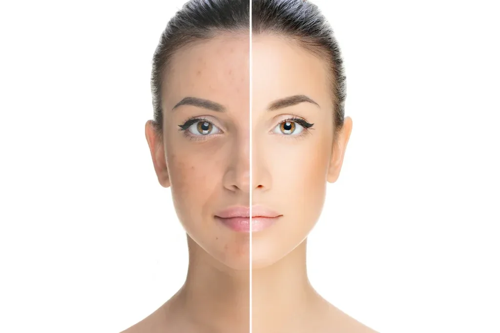 What Is Filler Made Of? Safe Ingredients Guide