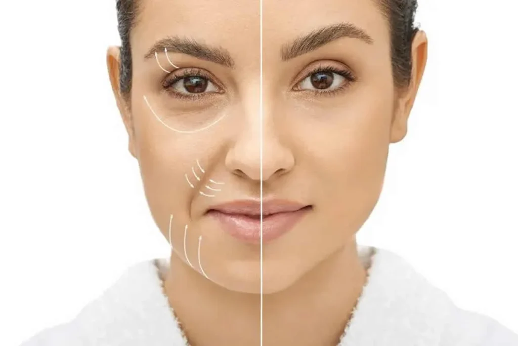 What Is Facial Filler Made Of? Proven Safety