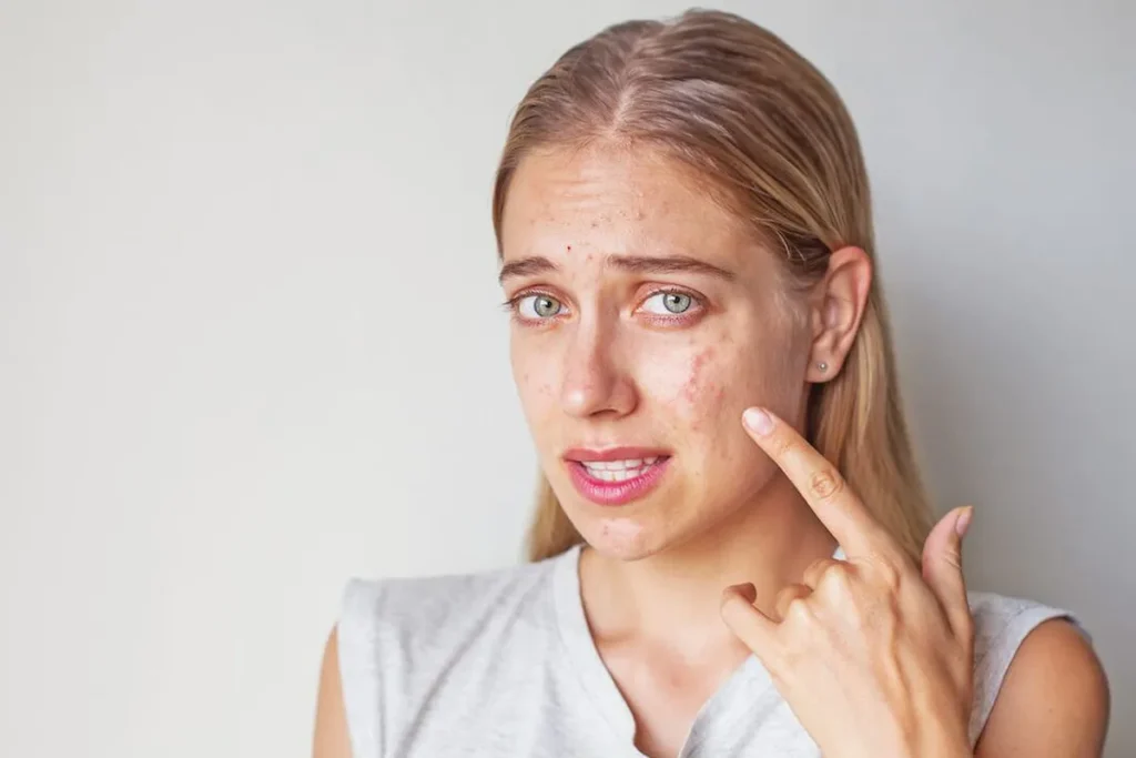 What Are Facial Fillers Made Of? Expert Insights