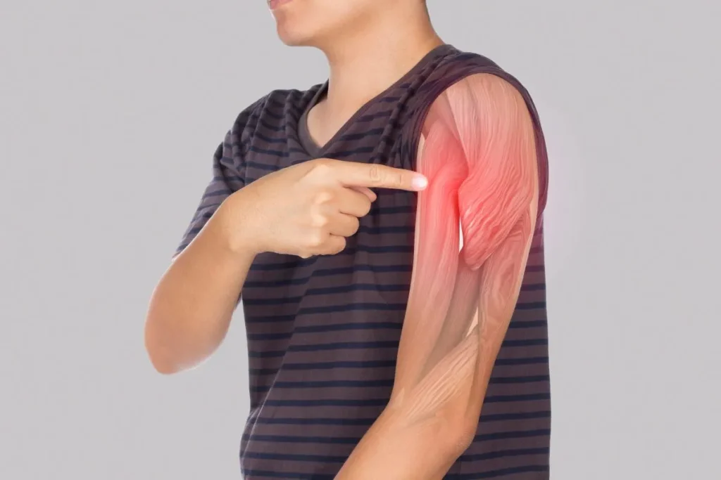 Muscle Relaxant Safe In Liver Disease: Top