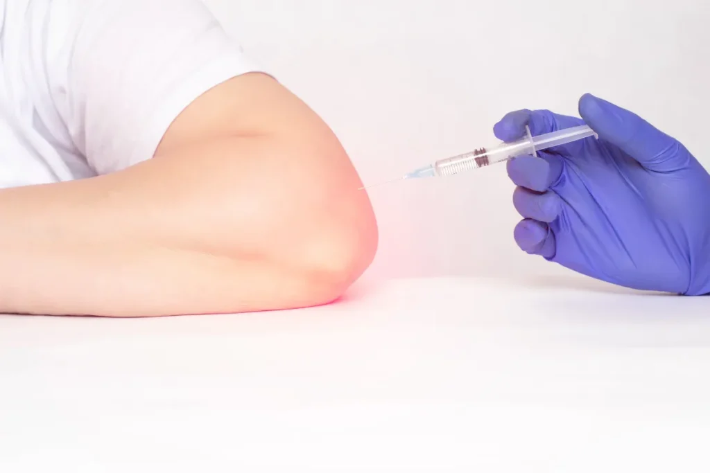 Do You Need To Rest After A Cortisone Injection?